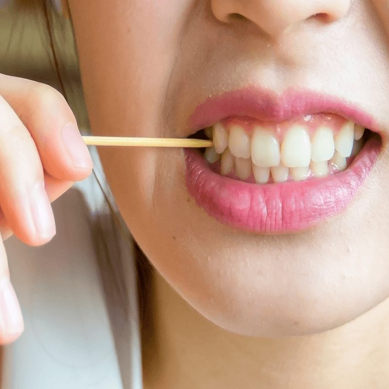 Cách điều trị răng thưa là gì?

