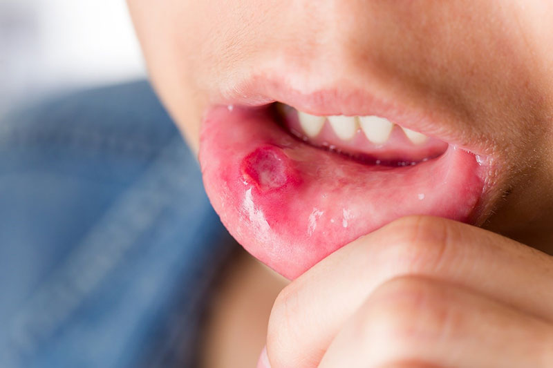 9 vấn đề răng miệng thường gặp và cách điều trị hiệu quả