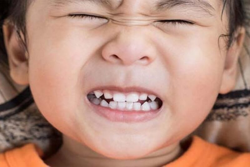Thói quen nghiến răng ở trẻ em
