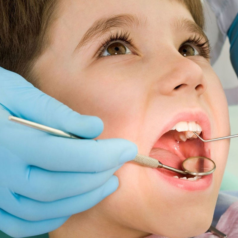 Trẻ em nên niềng răng khi nào là hợp lý nhất?
