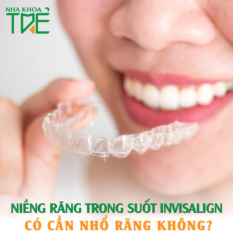 Niềng răng Invisalign có nhổ răng không? Nếu nhổ có nguy hiểm không?