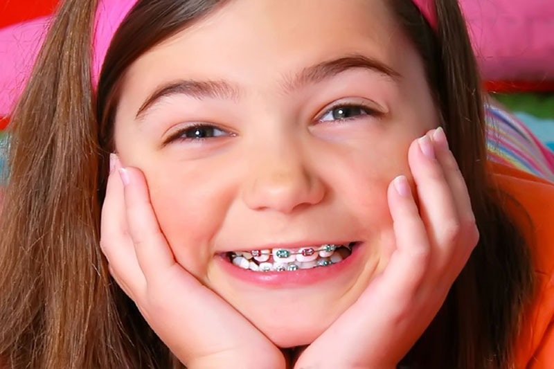 Niềng răng ở trẻ rút ngắn được nhiều thời gian hơn