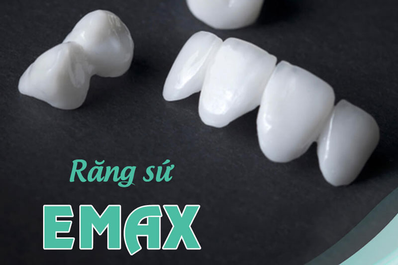 Răng sứ Emax - Răng sứ Thủy tinh