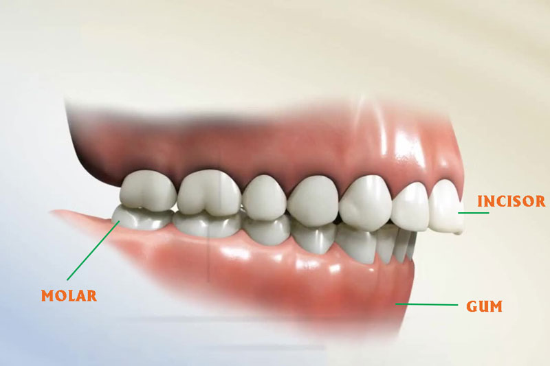 các tình trạng sai lệch răng cần niềng răng chỉnh nha để khắc phục