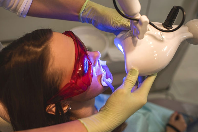 Thực hiện tẩy trắng răng sau khi niềng với công nghệ laser Whitening đảm bảo an toàn