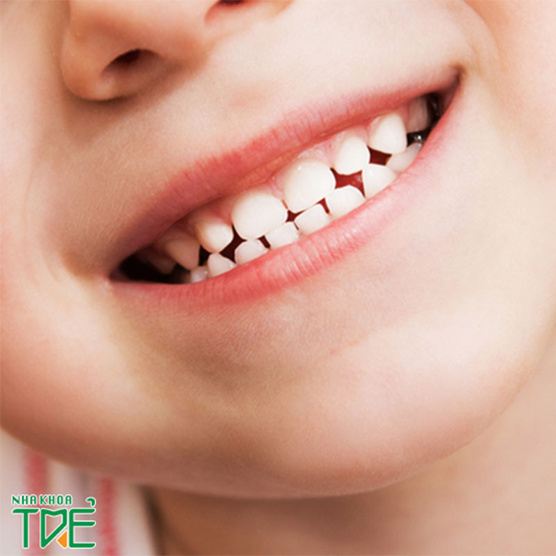 Thay đổi nào xảy ra khi răng sữa của em bé bắt đầu lớn lên và sẽ thay thế bởi răng vĩnh viễn?
