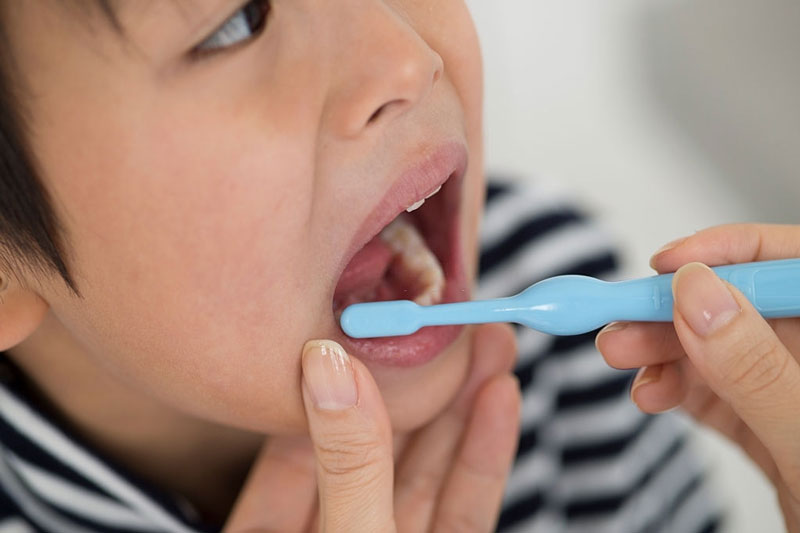 Cần hướng dẫn bé vệ sinh răng miệng đúng cách