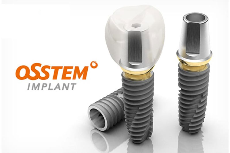 Trụ Implant OSSTEM được sử dụng rất phổ biến 