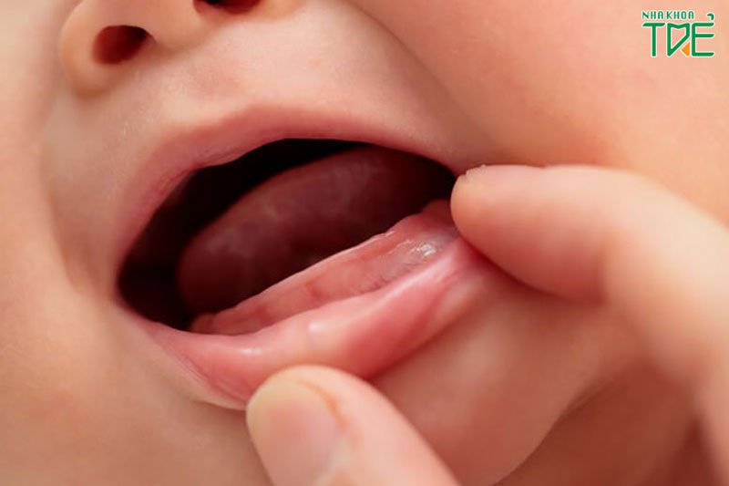 Mẹ nên làm gì khi bé 1 tuổi chưa mọc răng?