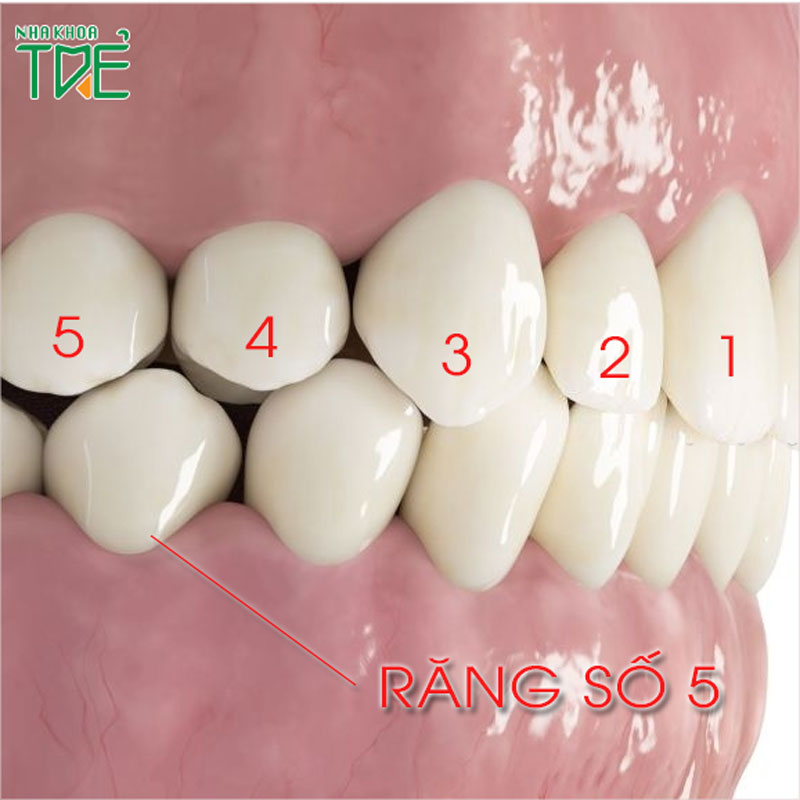 Răng số 5 là răng nào? Nhổ răng số 5 bị sâu có ảnh hưởng gì?