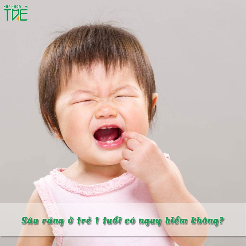 Sâu răng ở trẻ 1 tuổi: Những vấn đề mà bố mẹ cần lưu ý