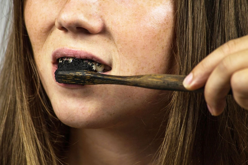 Làm trắng răng tại nhà sai cách có thể gây hại cho răng miệng