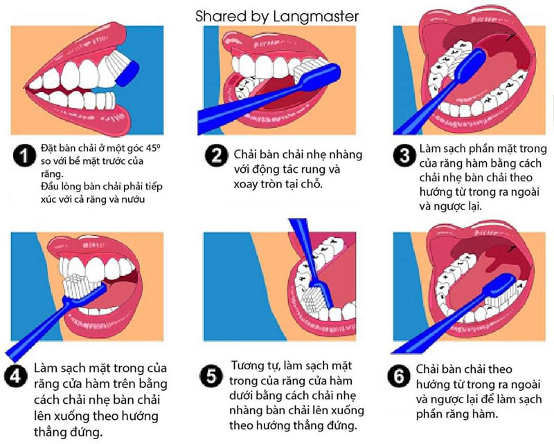 Chải răng đúng cách phòng ngừa tụt lợi chân răng