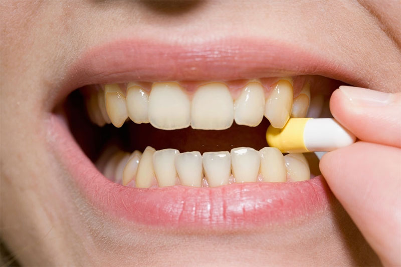 Sử dụng nhiều thuốc kháng sinh có thể làm răng bị nhiễm màu