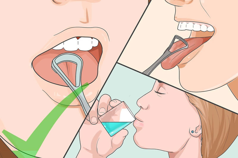 Chải lưỡi đúng cách để bảo vệ răng miệng lâu dài