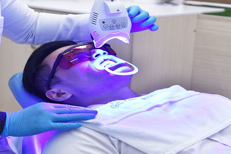 Công nghệ tẩy trắng răng cam kết cho bạn hàm răng trắng đẹp như mong muốn