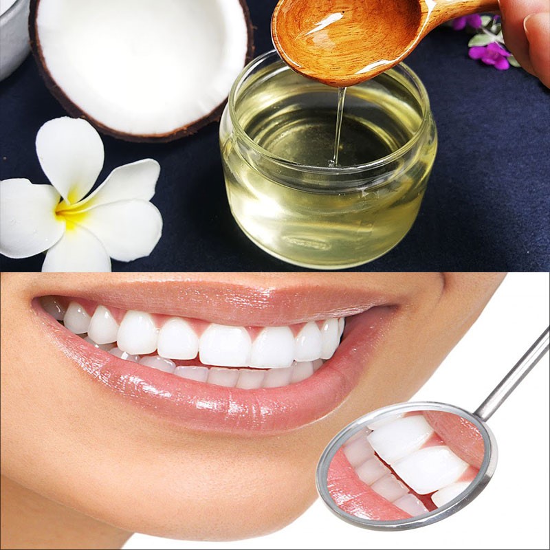 5 cách lấy cao răng bằng dầu dừa siêu hiệu quả