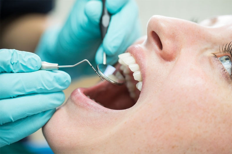 Khám răng miệng tổng quát để xác định tình trạng răng trước khi niềng