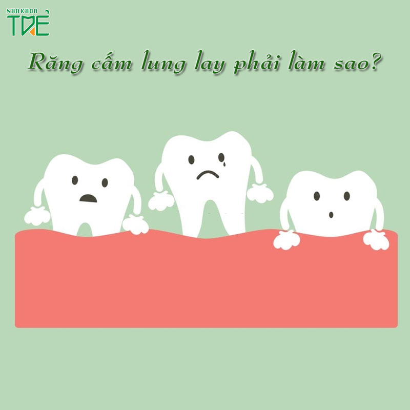 Răng cấm bị lung lay là do đâu? Cách khắc phục như thế nào?