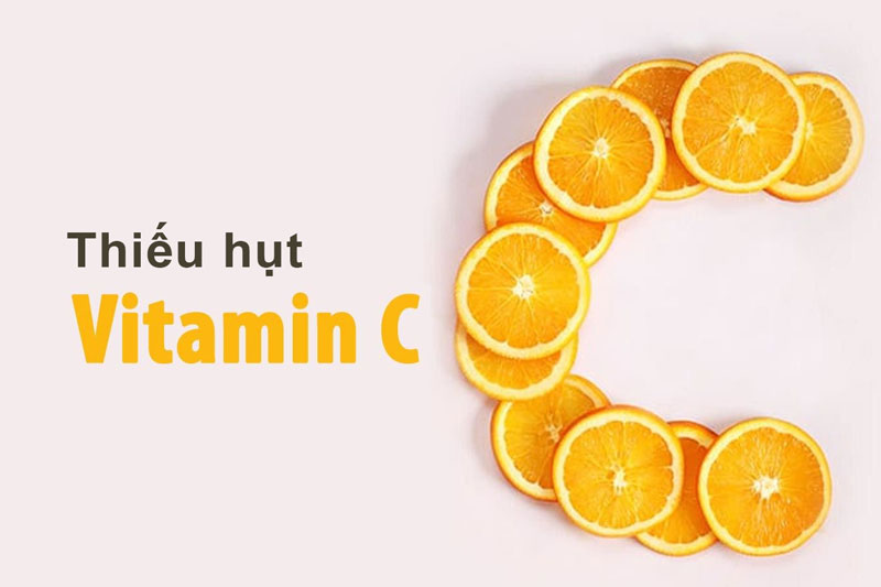 Thiếu hụt vitamin C có thể gây tình trạng chảy máu chân răng