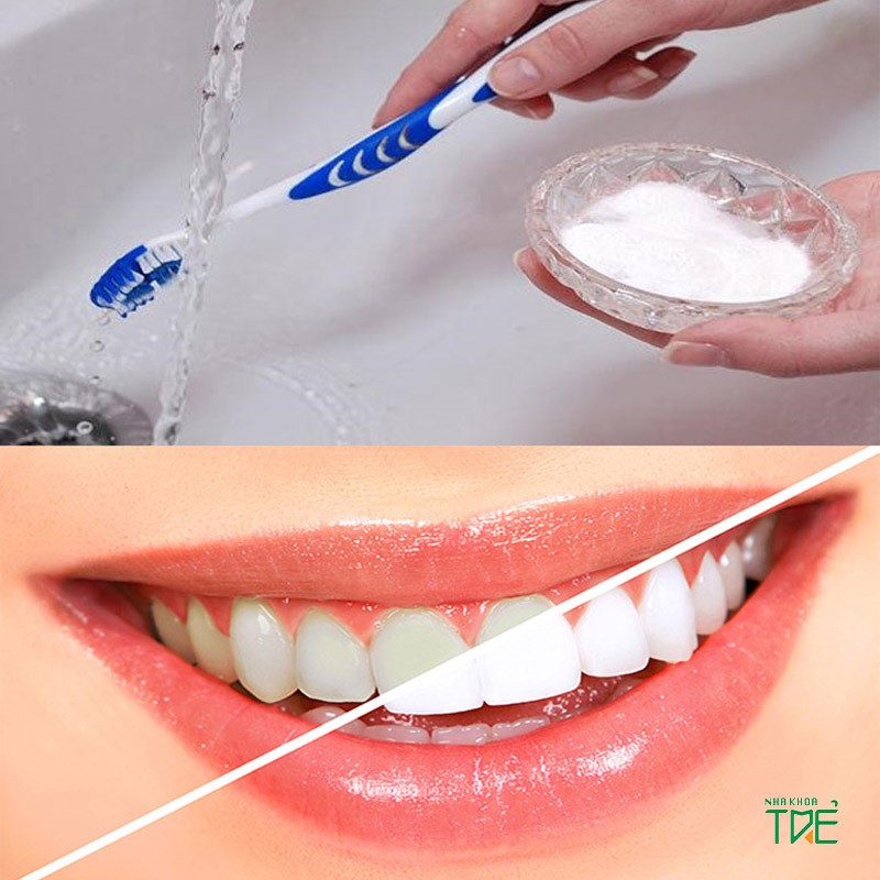 Bật mí các cách làm trắng răng bằng muối hiệu quả nhất