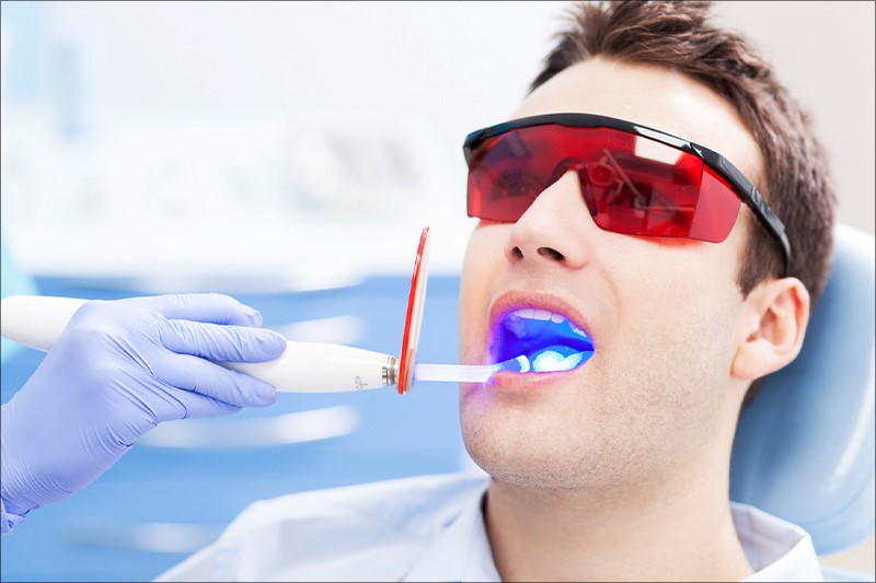Công nghệ tẩy trắng răng Laser Whitening giúp hàm răng trắng sáng an toàn