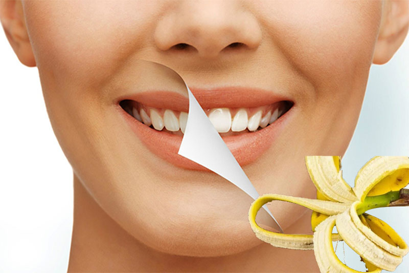 Sử dụng vỏ chuối để loại bỏ mảng bám ố vàng trên răng hiệu quả