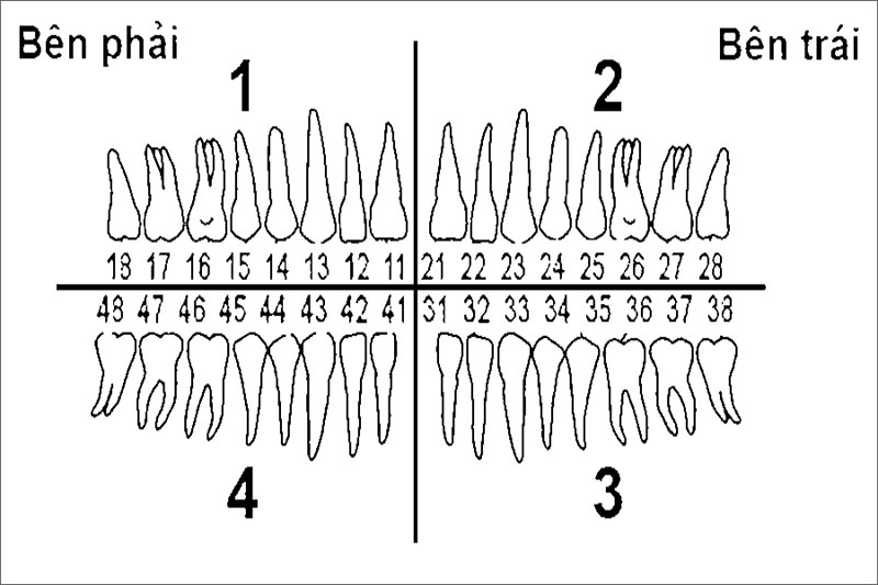 Những lưu ý sau khi nhổ răng số 18