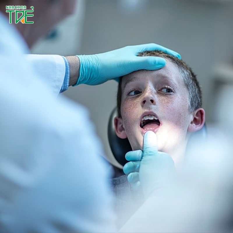 Niềng răng cho trẻ dưới 10 tuổi có nên không?