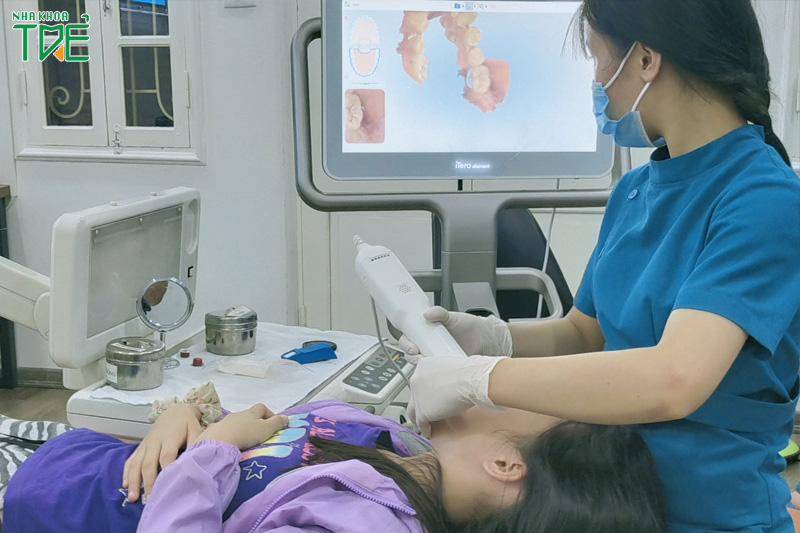 Ứng dụng công nghệ lấy dấu răng hiện đại trong chỉnh nha trẻ em để đạt kết quả cao