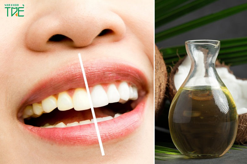 Các cách làm trắng răng bằng dầu dừa như thế nào?