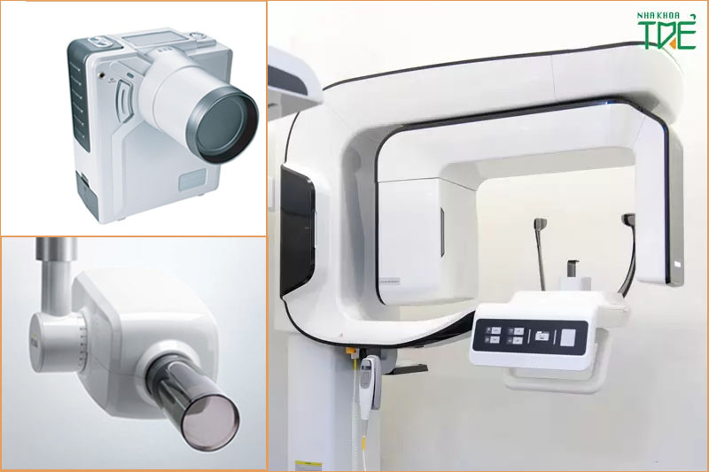 Các loại máy chụp X-quang cần thiết trong nha khoa