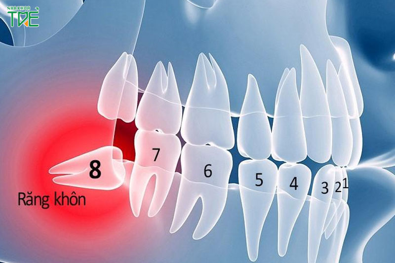Nhổ răng số 6, 7, 8 gây ảnh hưởng gì?