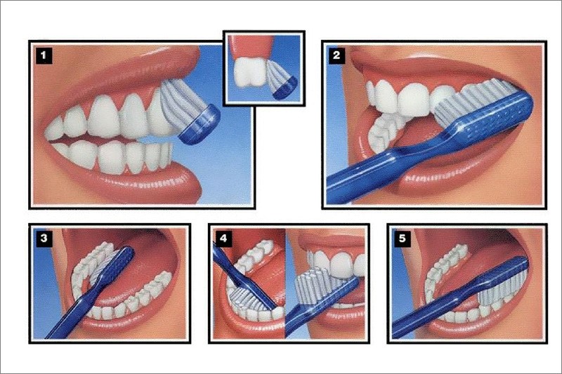 Chải răng đúng cách là một thói quen tốt cho răng miệng, đảm bảo an toàn cho răng lợi