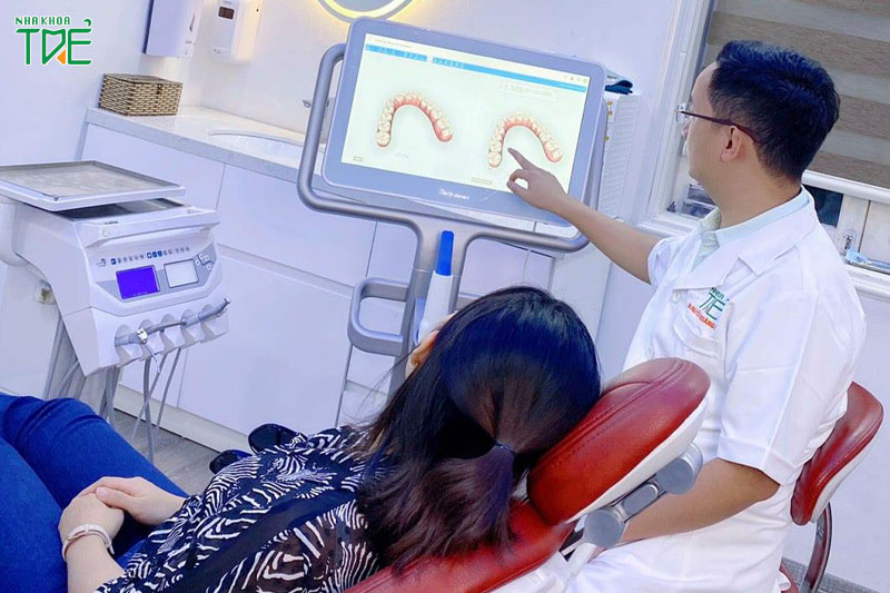 Máy Scan răng Itero kết hợp với phần mềm Clincheck sẽ xem trước được quá trình niềng răng