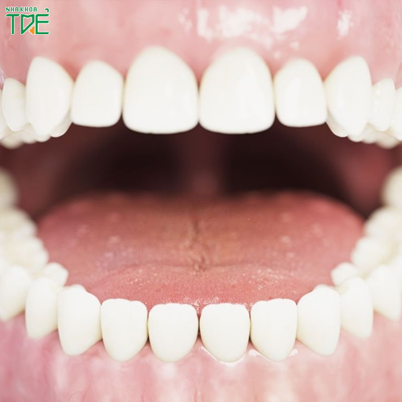 Răng số bao nhiêu trên hàm được coi là răng cấm?
