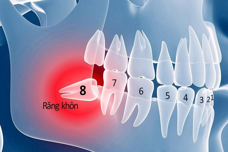 Răng khôn số 8 nằm ở vị trí cuối cùng và gây ra nhiều rắc rối cho răng miệng