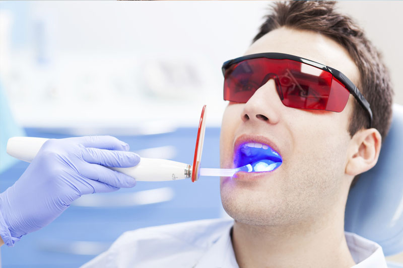 Tẩy trắng răng Laser hiệu quả nhanh chóng và an toàn