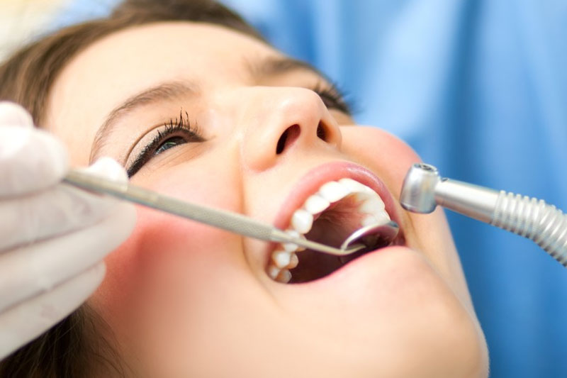 Lấy cao răng là phương pháp điều trị cơ bản đối với tình trạng viêm nướu gây tụt lợi