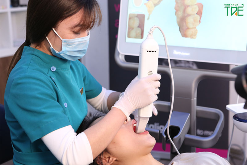Scan răng Itero hiện đại cho bạn trải nghiệm thoải mái khi chỉnh nha