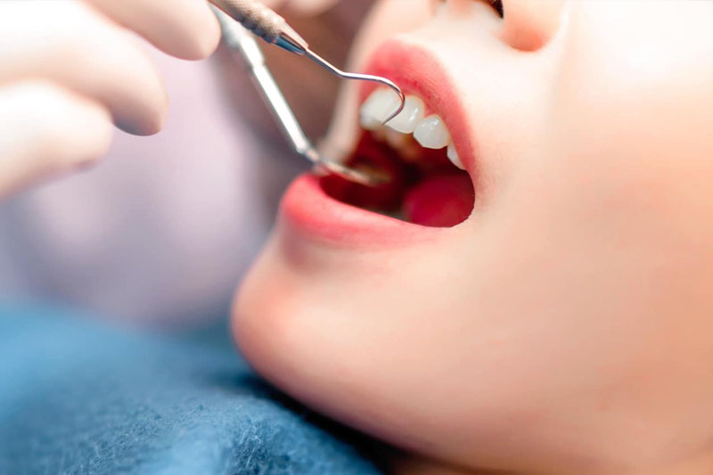 Khám răng miệng định kỳ là rất cần thiết để bảo vệ sức khỏe răng miệng