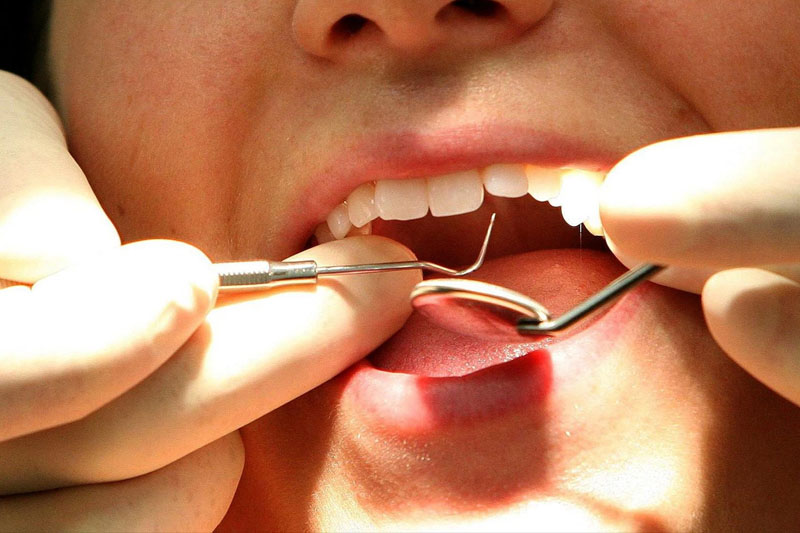 Hàn răng không đau với công nghệ nha khoa hiện đại