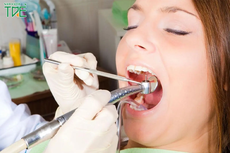 Điều trị tủy răng là cần thiết để bảo vệ sức khỏe răng miệng
