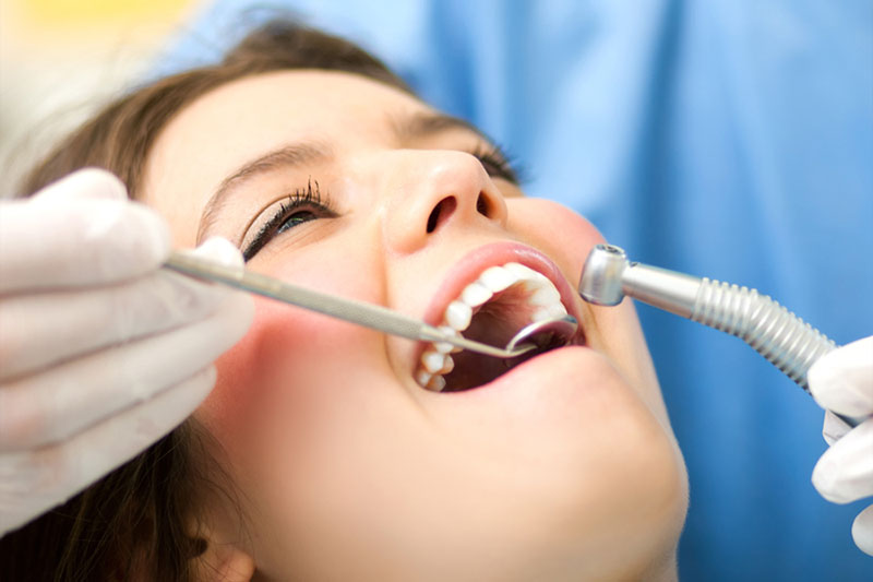 Lấy cao răng siêu âm nhẹ nhàng, an toàn, không đau nhức