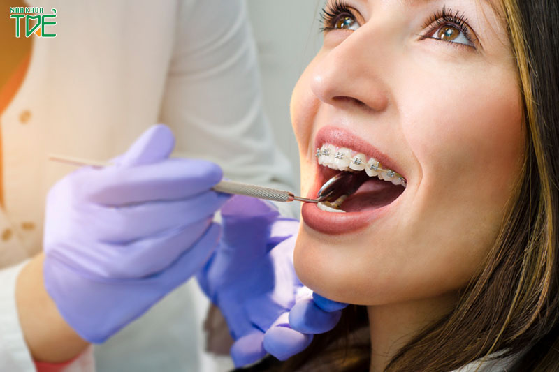 Hiệu quả của quá trình niềng răng hô phụ thuộc vào tay nghề bác sĩ điều trị