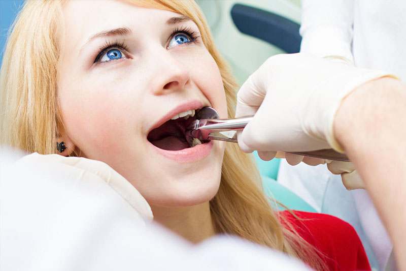 Nhổ răng khôn là chỉ định cần thiết để bảo vệ răng miệng khỏe mạnh