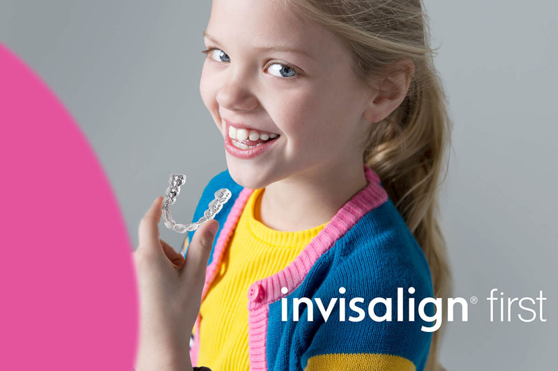 Niềng răng Invisalign - giải pháp chỉnh nha tối ưu cho trẻ