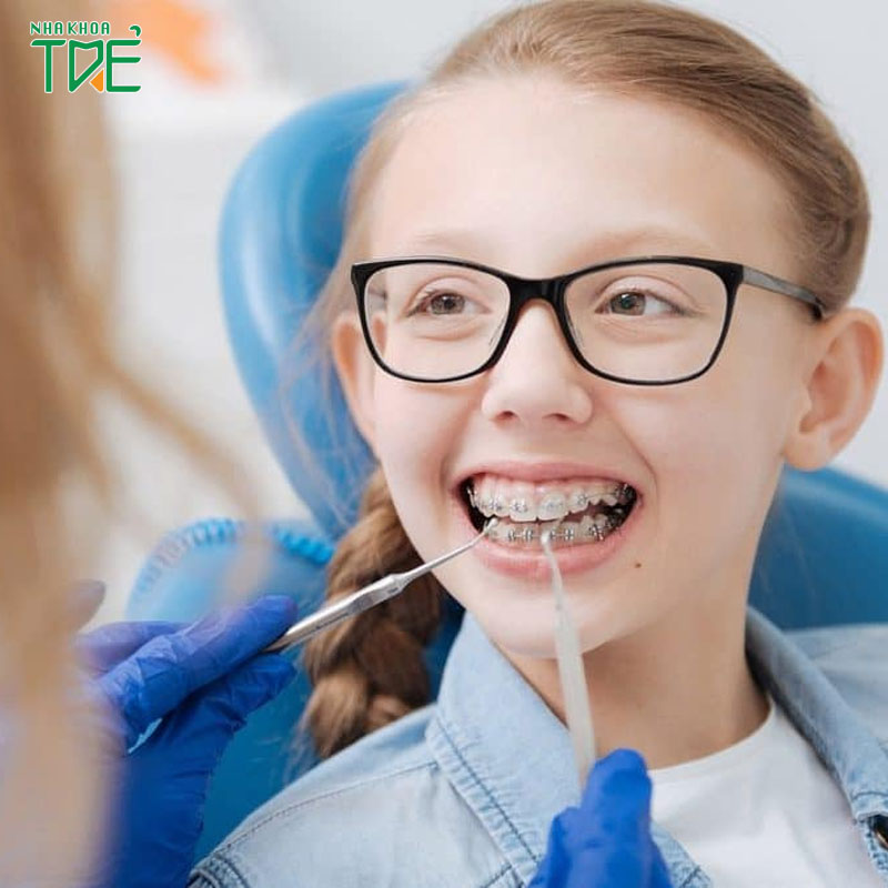 Các phương pháp niềng răng cho trẻ em theo độ tuổi cụ thể