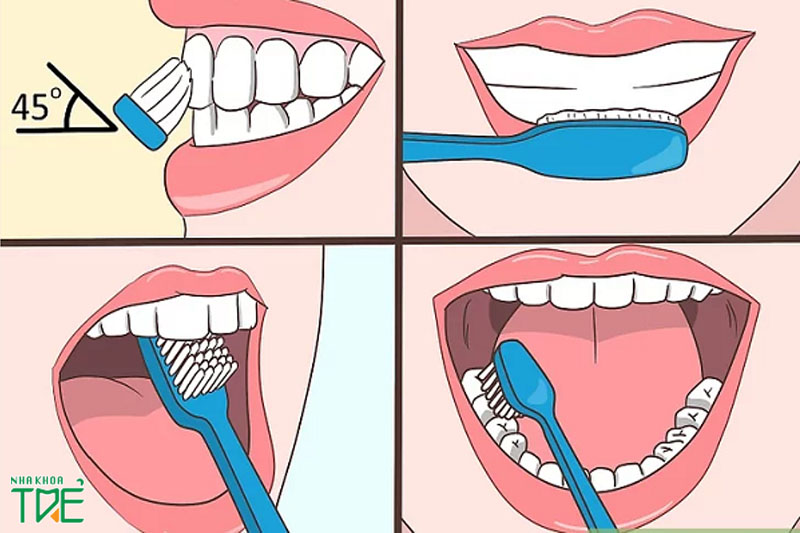 Chải răng đúng cách để hạn chế tổn thương răng miệng