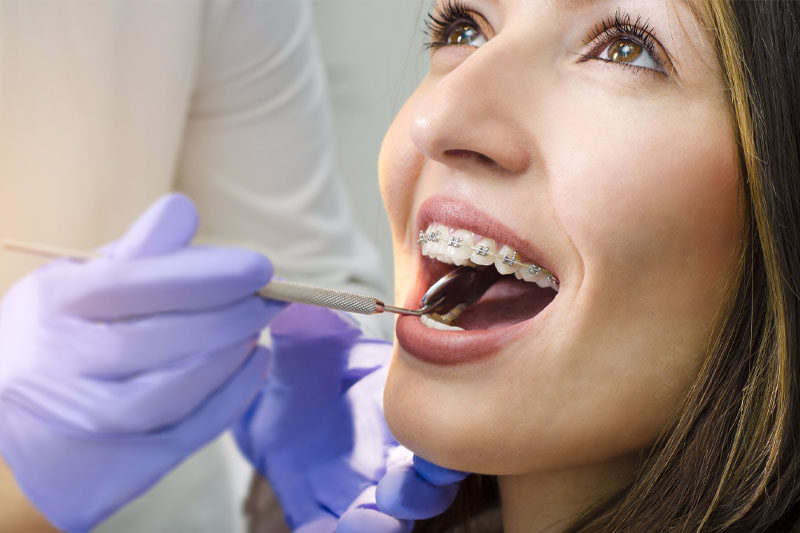 Niềng răng khắc phục các vấn đề liên quan đến răng và khớp cắn
